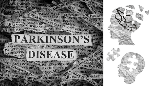 Survival in patients with Parkinson's disease: a ten-year follow