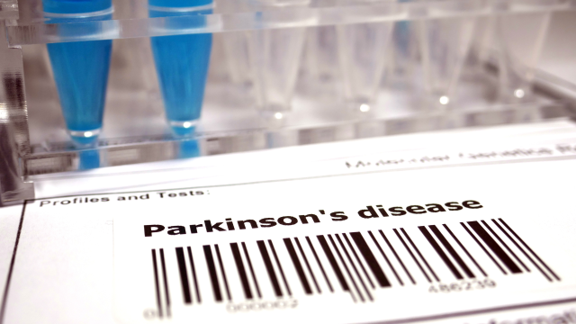 Highlighted in recent literature reviews, a multitude of studies find associations between pesticide exposure and Parkinson's disease. Highlighted in recent literature reviews, a multitude of studies find associations between pesticide exposure and Parkinson's disease.