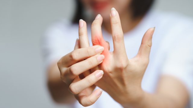 Women, through direct and indirect exposure to organochlorines and other pesticides, have an increased risk of rheumatoid arthritis. Women, through direct and indirect exposure to organochlorines and other pesticides, have an increased risk of rheumatoid arthritis.