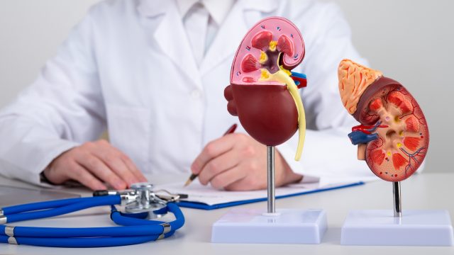 New research from France shows occupational exposure to pesticides, for both men and women, causes increased risks for kidney cancer.